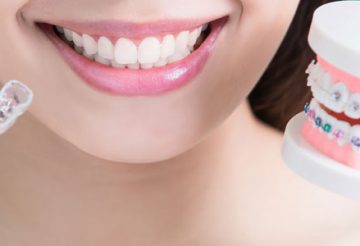 Traitement orthodontique Invisalign