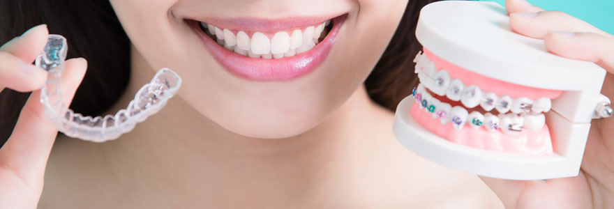 Traitement orthodontique Invisalign