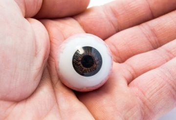 Prothèse oculaire